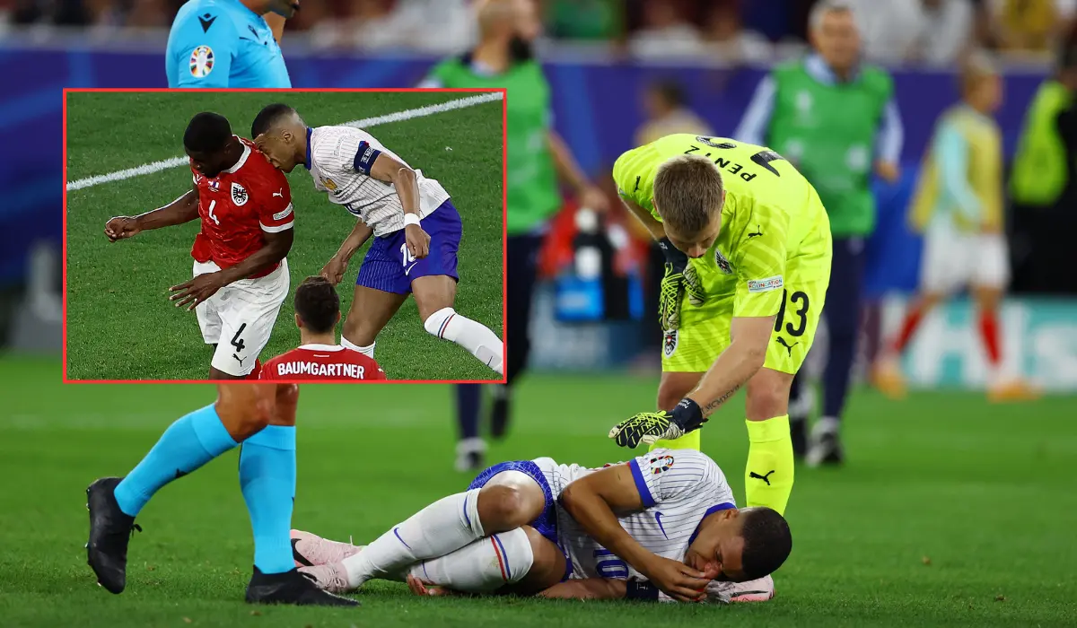 Mbappe vỡ mũi, phải nhập viện phẫu thuật khẩn cấp