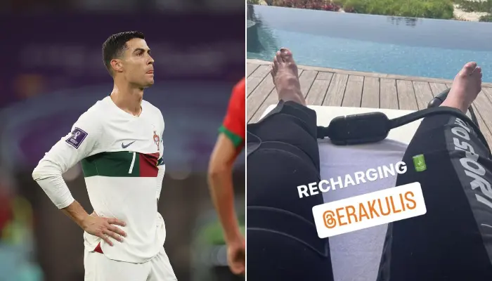 bàn chân sưng tấy của Cristiano Ronaldo