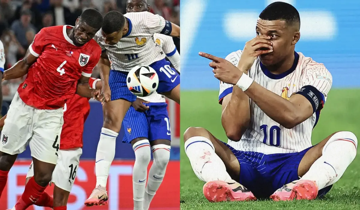 'Tay tôi quá lực': Đối thủ tự hào vì làm gãy mũi Mbappe?